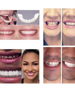 Perfect Smile Snap On Braces