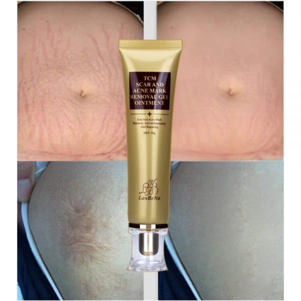 Acne Scar Remover Cream - Image 6