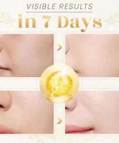 Line-Rescue Golden Collagen Peptide Kit