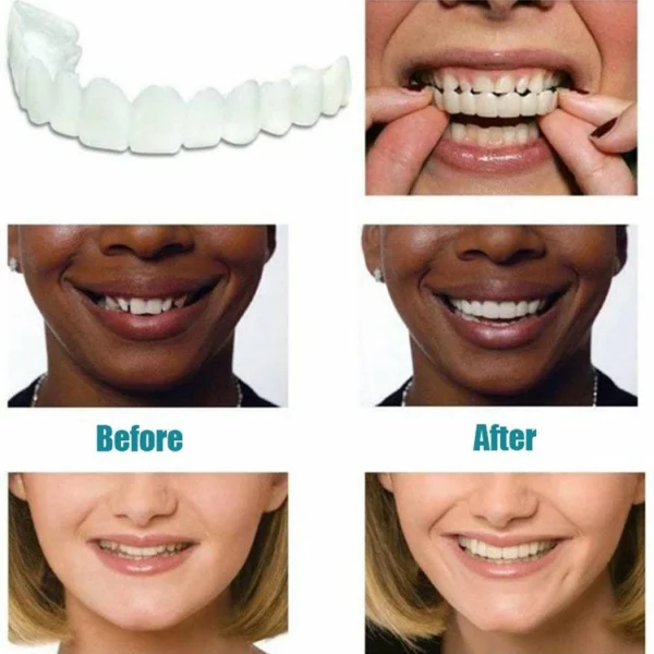 MAGIC TEETH BRACE!