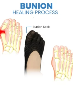 Wingle Anti-Bunions Health Sock