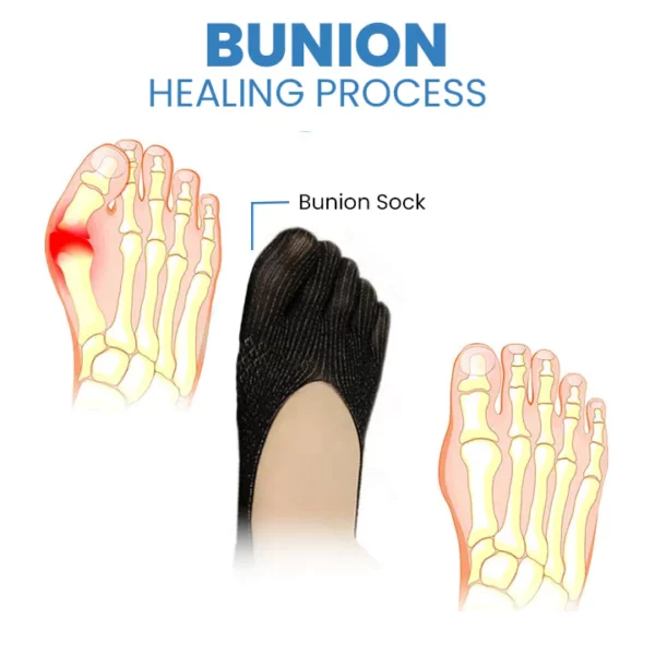 Wingle Anti-Bunions Health Sock