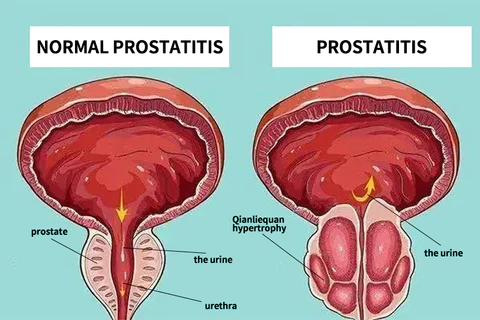 Clinically Proven Effective - Exclusive Patented Prostate Care