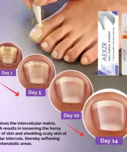 AEXZR™ Nail Fungal Essence