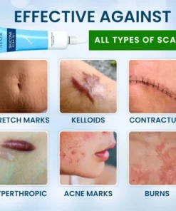 AEXZR™ Silicone Scar Gel