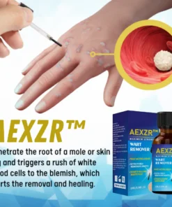 AEXZR­™ Skin Tag Remover