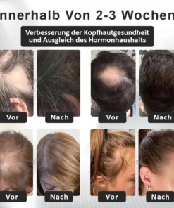 ATTDX™ Alopecia Wiederherstellungs Haar Booster Roll-On