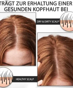 ATTDX™ Alopecia Wiederherstellungs Haar Booster Roll-On