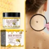 Bee poison Wart and Mole Removal Treatment Cream