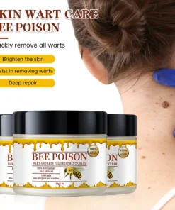 Bee poison Wart and Mole Removal Treatment Cream