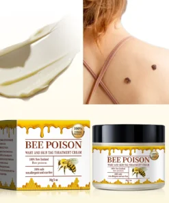 Bee poison Wart and Mole Removal Treatment Cream