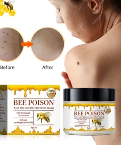 Bee poison Wart and Mole Removal Treatment Cream