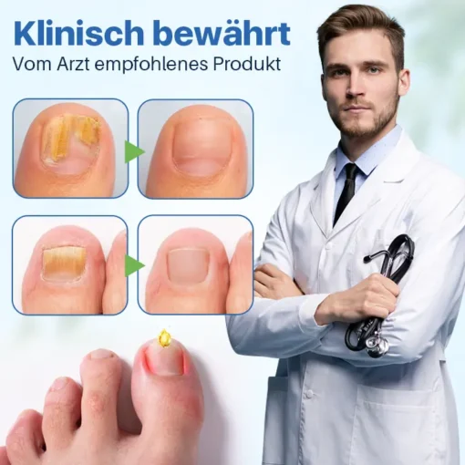 Biancat™ Antifungale Nagelreparatur-Salbe