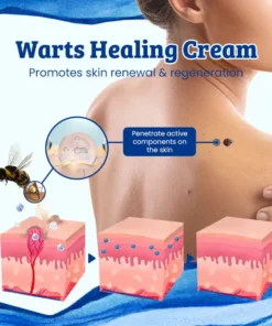 Ceoerty™ CurSkin Bee Venom Psoriasis & Wart Healing Cream