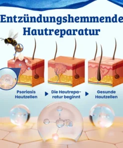 Ceoerty™ CurSkin Bienengift Schuppenflechte & Warzenheilungscreme