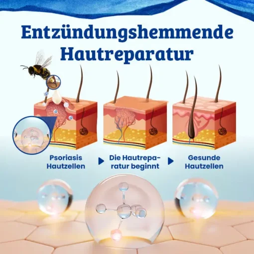 Ceoerty™ CurSkin Bienengift Schuppenflechte & Warzenheilungscreme