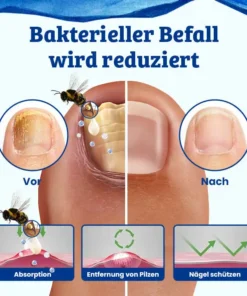 Ceoerty™ CurSkin Bienengift Schuppenflechte & Warzenheilungscreme