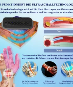 CircuWave™ Venenunterstützungs UltrasonicBand