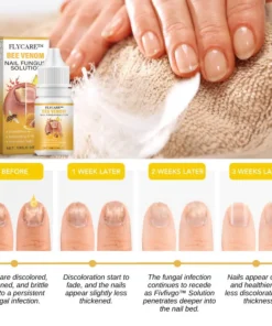 FLYCARE™ BeeVenom Nail Fungus Solution