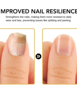 FLYCARE™ BeeVenom Nail Fungus Solution