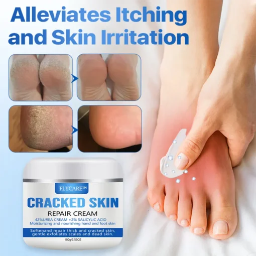 FLYCARE™ Cracked Skin Repair Cream