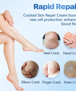 FLYCARE™ Cracked Skin Repair Cream