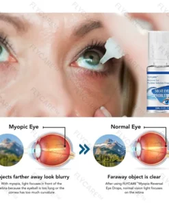 FLYCARE™ Myopia Reversal Eye Drops