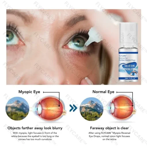 FLYCARE™ Myopia Reversal Eye Drops