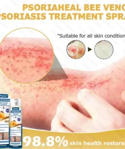 FLYCARE™ PsoriaHeal Bee Venom Psoriasis Treatment Spray