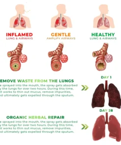 FLYCARE™ RespiAid Herbal Lung Cleansing Spray