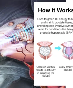 Flycare™ ProstateFlow RF Therapy Band Pro