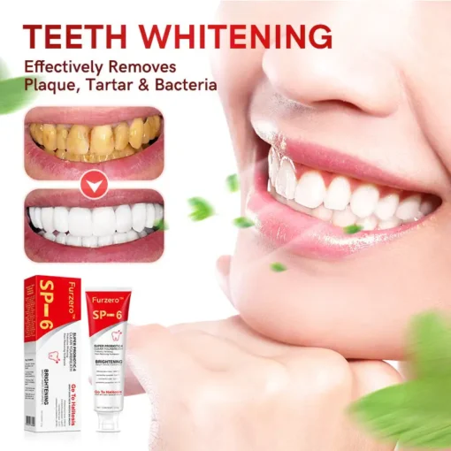 Furzero™ Aussie SP-6 Probiotic Ultra Whitening Toothpaste