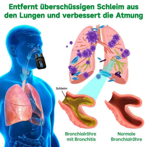 Furzero™ Kräuter-Lungenreiniger-Inhalator