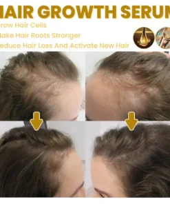 LIMETOW™ Spray-on Hair Growth Essence