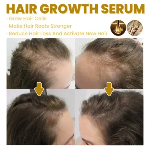 LIMETOW™ Spray-on Hair Growth Essence