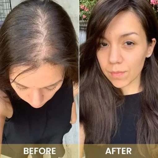 LIMETOW™ Spray-on Hair Growth Essence