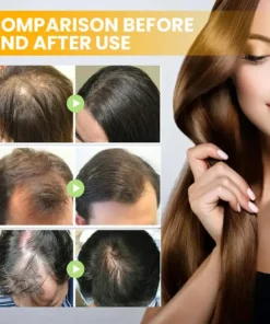 LIMETOW™ Spray-on Hair Growth Essence