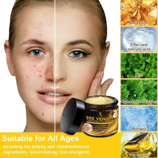 RTSSKE™ Bee Venom Skin Cream