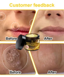 RTSSKE™ Bee Venom Skin Cream