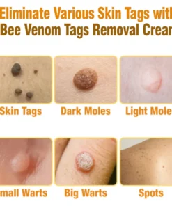 flysmus™ Bee Venom Tags Removal Cream