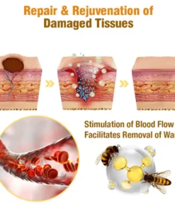 flysmus™ Bee Venom Tags Removal Cream