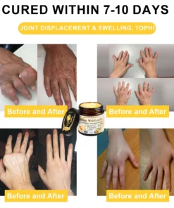 𝐒𝐩𝐳𝐯™ Bee Venom Arthritis Therapy Cream(Specially for older adults & AAOS recommends)