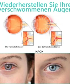 Bostorer™ Augentropfen zur Behandlung von Sehproblemen