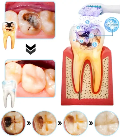 DOCTIA™ TeethRestoration Mineralpulver