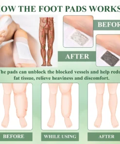 DetoxFlow™ SwellRelief Lymphatic Foot Pads