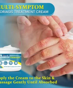 EMA-Certified - Ourlyard™ Advanced Multi-Symptom Psoriasis Treatment Cream - Dermatologist Approved - 75% OFF