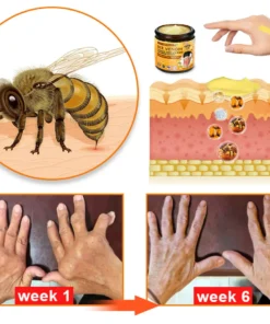 Furzero™ Bee Venom & Turmeric Joint and Bone Pain Relief Cream (Specializes in Joint and Arthritis Pain & AAOS Recommends)