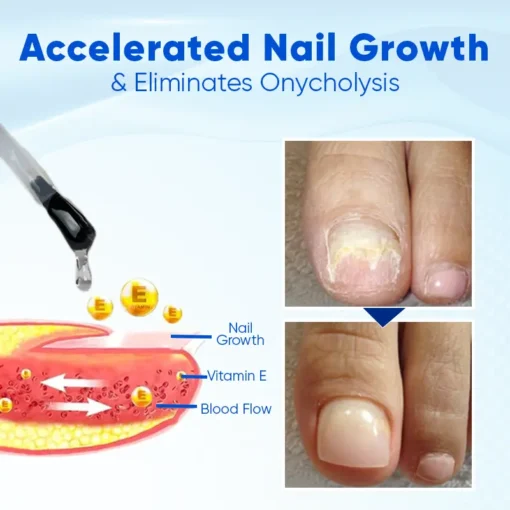 LOVILDS™ OnyxoGuard Nail Growth and Repair Serum