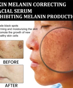 NESLEMY™ Melanin Correcting Facial Serum