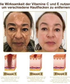 PLTOWE® leistungsstarke Ganzkörper-Hautpflegecreme